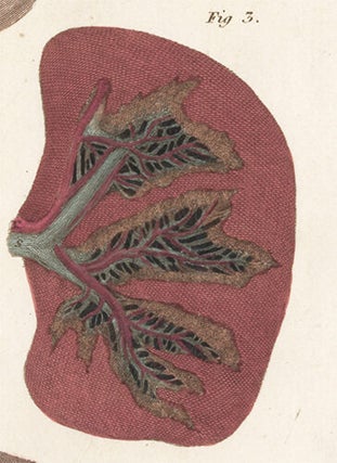 Liver, pancreas, spleen and stomach. Anatomical Plates of the Human Body.