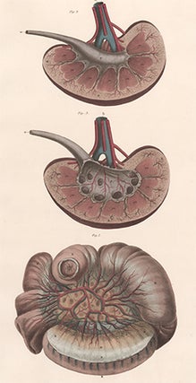 Item nr. 151700 Jejunum and kidneys. Anatomical Plates of the Human Body. John Lizars