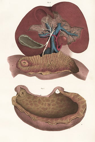 Item nr. 151710 Liver, gall bladder, stomach and duodenum. Anatomical Plates of the Human Body. John Lizars.