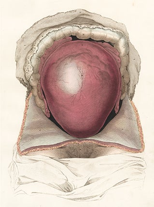 Item nr. 151756 Gravid uterus in situation. Anatomical Plates of the Human Body. John Lizars
