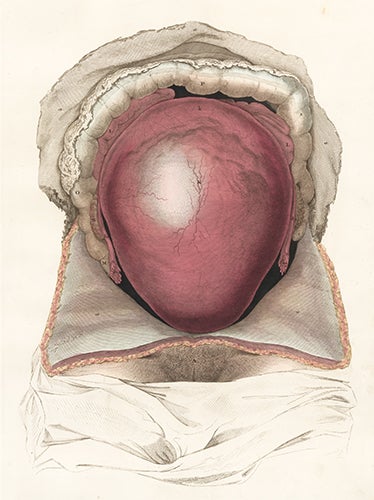 Item nr. 151756 Gravid uterus in situation. Anatomical Plates of the Human Body. John Lizars.
