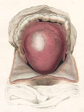 Gravid uterus in situation. Anatomical Plates of the Human Body.