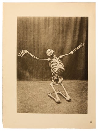 Item nr. 172071 Ein Anatomischer Totentanz. Albert Hasselwander
