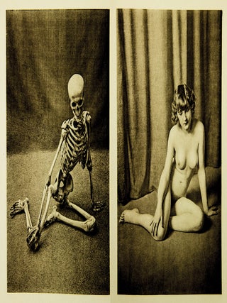 Ein Anatomischer Totentanz.