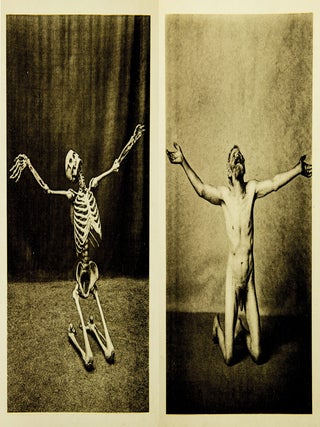 Ein Anatomischer Totentanz.
