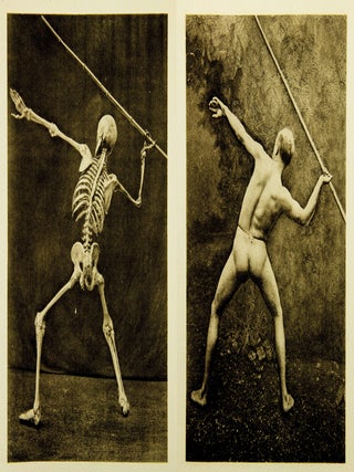 Ein Anatomischer Totentanz.