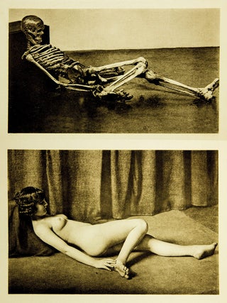 Ein Anatomischer Totentanz.