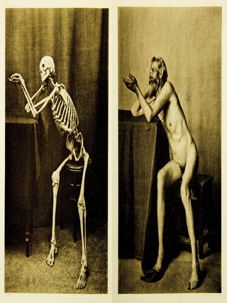 Ein Anatomischer Totentanz.