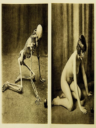 Ein Anatomischer Totentanz.